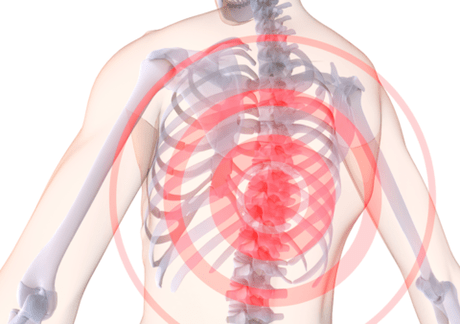 Breast pain