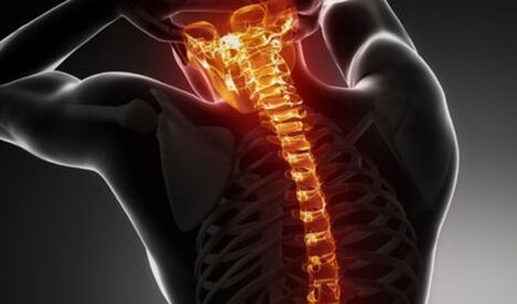 Osteochondrosis of the entire vertebral column