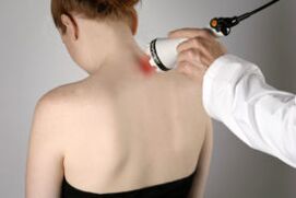Treatment of cervical osteochondosis with laser therapy