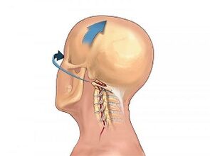 How the osteochondosis of the cervical column is manifested